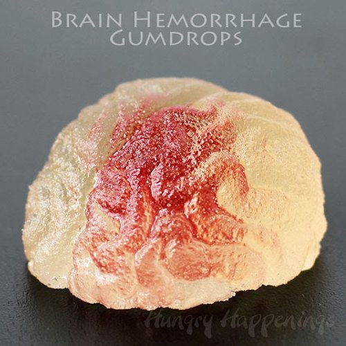 Brain Hemorrhage Gumdrops